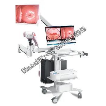 Кольпоскоп CE clear KN-2200I (H) экран для кольпоскопии при раке шейки матки full hd цифровой кольпоскоп камера гинекологический кольпоскоп